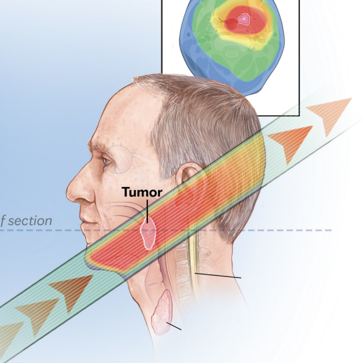 Medical illustration