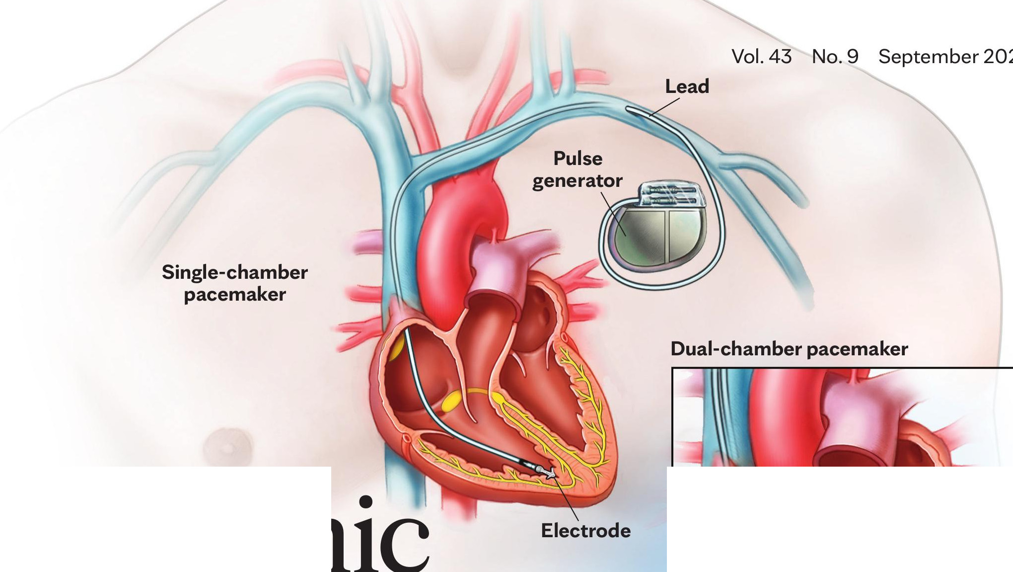 Breast cancer – Test Content